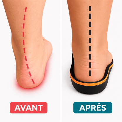 Enzica™ – Semelles orthopédiques professionnelles - Tsunaya
